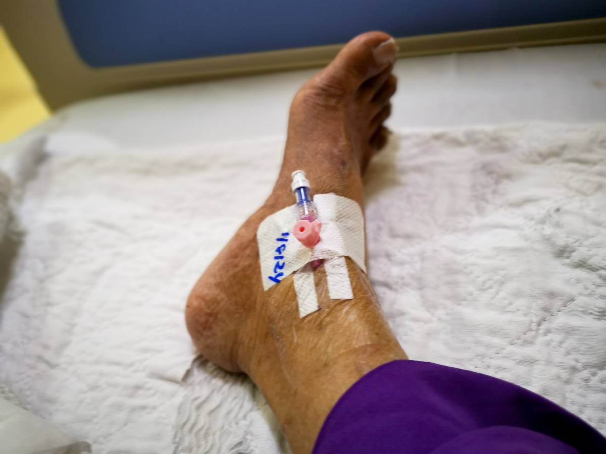 IV Access in the Lower Extremities for Anesthesia and Surgery