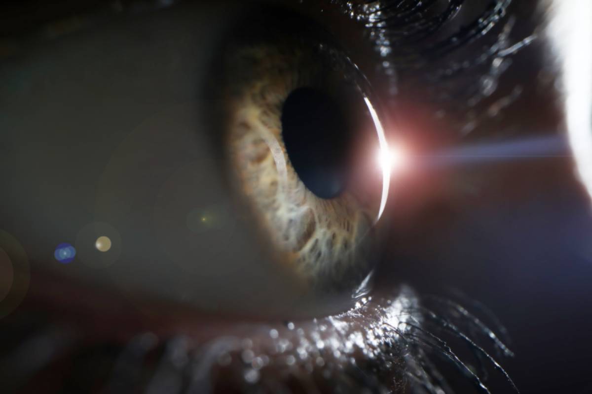 <strong>Anesthesia Considerations for Glaucoma Surgery</strong> 