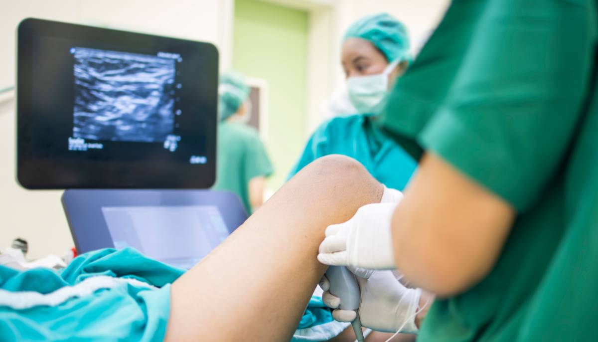 Downsides of Peripheral Nerve Blocks