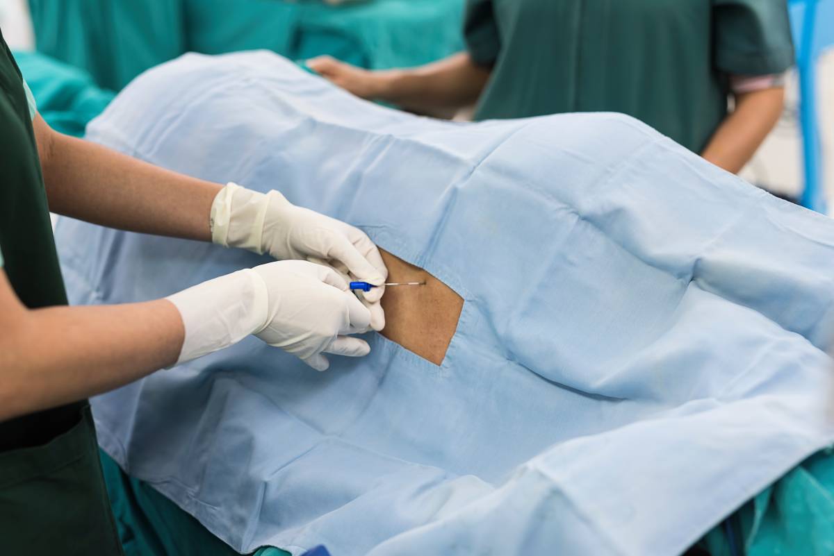 Epidural Blood Patch in Anesthesia