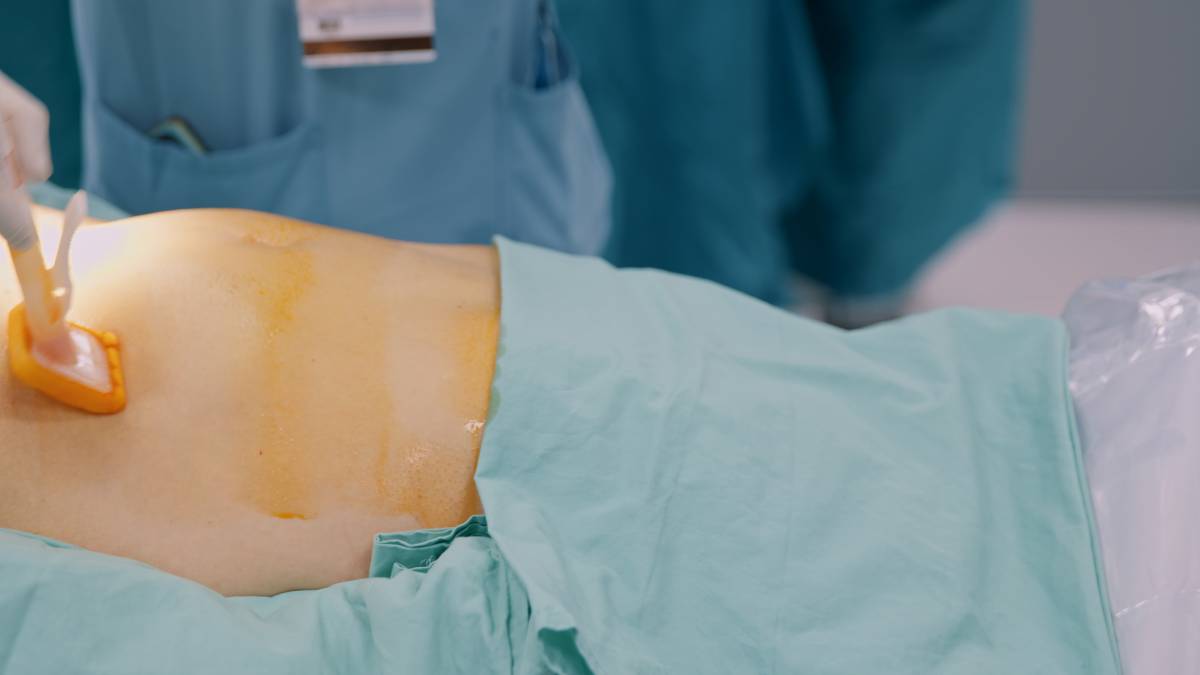 Patient Skin Preparation Protocols